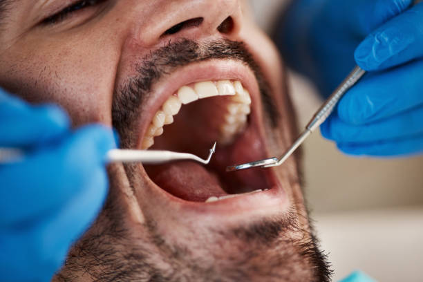 Best Emergency Cosmetic Dentistry (e.g., broken veneers) in Carterville, MO